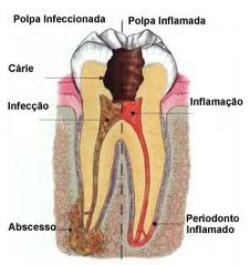 Explicação 1